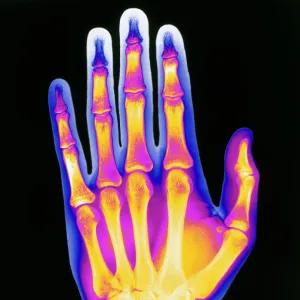 Coloured X-ray of the healthy hand of a man