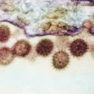 Crimean-Congo haemorrhagic fever virus