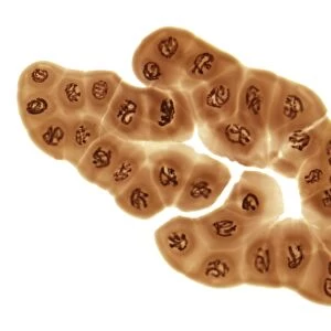 Giant chromosomes, light micrograph F006 / 9794