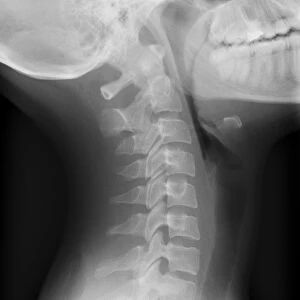 Healthy spine of the neck, X-ray