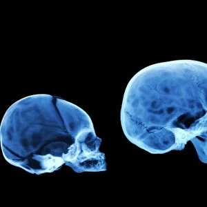 Human skull development