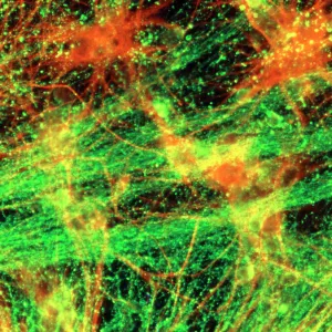 Immunofluorescent LM of neurons & astrocytes