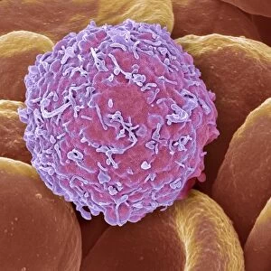 Leukaemia cell, SEM