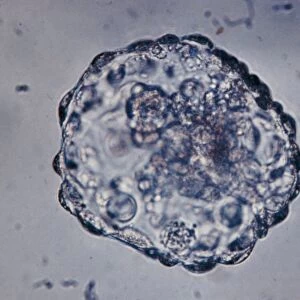 LM of blastocyst (six day embryo) after hatching
