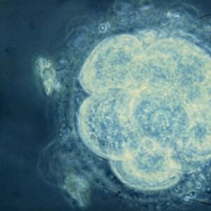 LM of human embryo at eight cell stage
