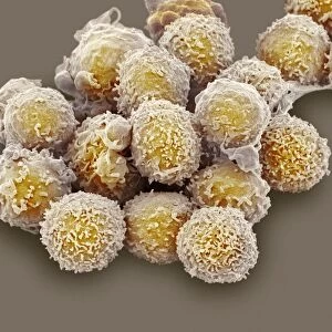 Lymphocyte white blood cells, SEM C016 / 9138
