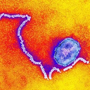 Measles virus particle, TEM C015 / 7164