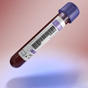 Medical test tube with blood, artwork