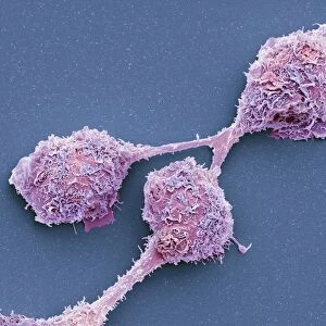 Microglial white blood cells, SEM C016 / 9111