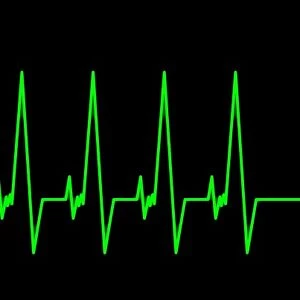 Near-death experience, heartbeat trace C013 / 9462