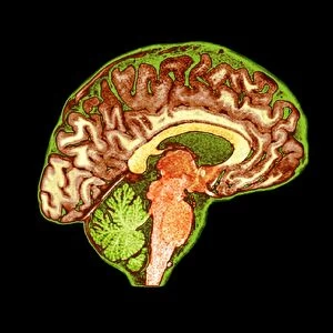 Normal human brain, MRI scan C016 / 8837