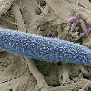 Paramecium protozoan, SEM