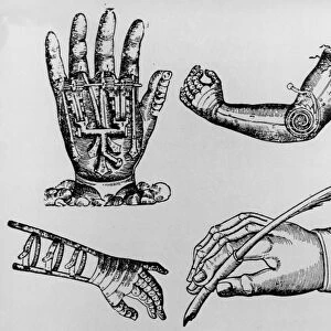 Selection of 16th century artificial arms & hands