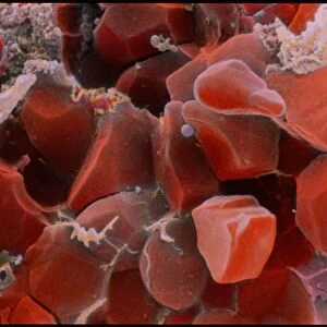 SEM of blood clot