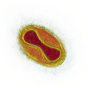 Smallpox virus particle, TEM
