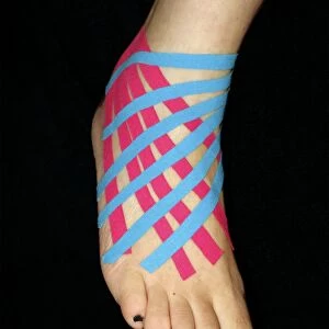 Taped sprained ankle C017 / 3695