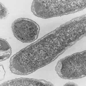 TEM of Escherichia coli 0157: H7 bacteria