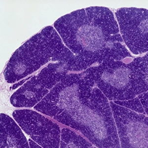 Thymus gland, light micrograph C015 / 4970