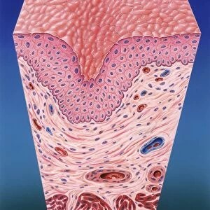 Urinary bladder wall, artwork