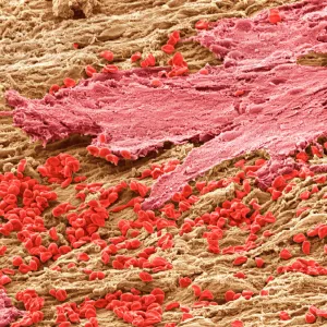 Uterus lining during menstruation, SEM