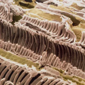 Xylem and parenchyma in Rhubarb stem