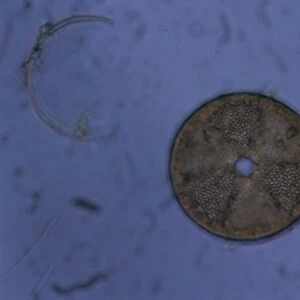 acrinoptychus senarius living in the plankton x130 magnification