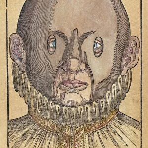A mask for treating strabismus (crossed eyes). Woodcut from Georg Bartischs Ophthalmodouleia, das ist Augendienst, 1583