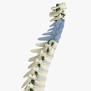 Digital illustration of human spine with damaged area highlighted in blue resulting in quadriplegia