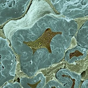 Nerve fibers, scanning electron micrograph
