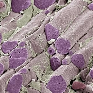 Skeletal muscle fibers, colored scanning electron micrograph (SEM)