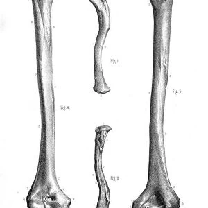Thoracic limbs anatomy engraving 1866