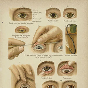 The eye (colour litho)