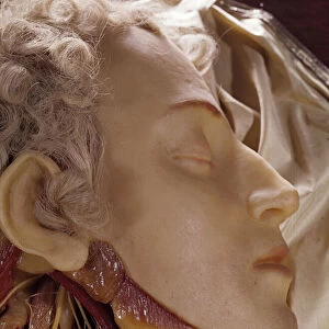 Model of a man whose throat has been cut (wax)
