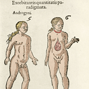 Representation of an androgynous and a hermaphrodite. Plate taken from De natura Divinis
