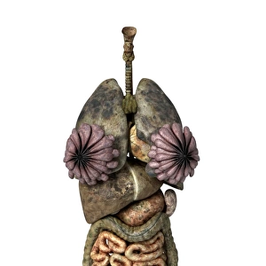 3D rendering of unhealthy female internal organs