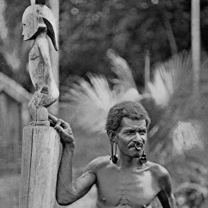 Malformation of the ears, Solomon Islands, 1920. Artist: JW Beattie