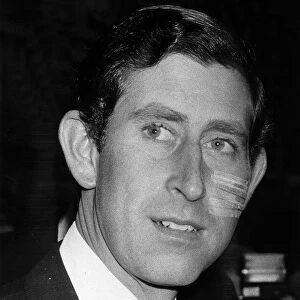Prince Charles with six stitches on face, covered with plasters May 1980
