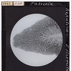Fascicola hepatica: posterior extremity enlarged under a microscope. (Trematodea)
