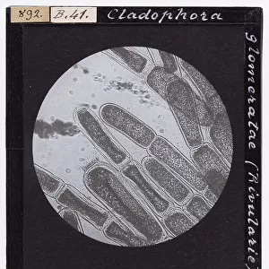 Microscopic enlargement of vegetative cells of Cladophora Glomeratae (Rivularie)