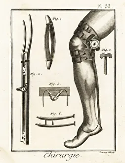 18th century surgical knee pad and dislocation machine 18th century surgical knee pad and dislocation machine