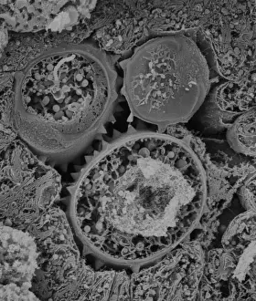 Scanning Electron Microscope Image Prints: Asteraceae, daisy