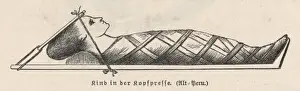 Historical Medical Equipment Prints: Compression of Head