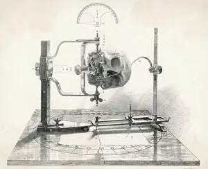 Craniometer Print: Mid 19th Century Skull Measurement Device