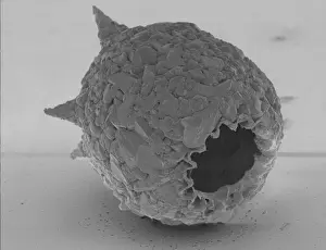 Difflugia Corona Freshwater Testate Amoebae Print, Magnification x 450