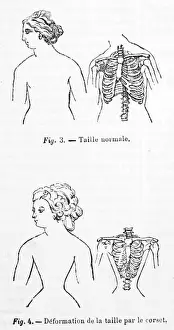 The Awful Truth Prints: Corset Wearing Effects Print