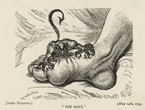 Gout Devil Bites Print, 1799 Engraving of a demon attacking a swollen foot