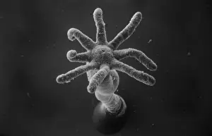 Scanning Electron Microscope Image Prints: Hydra sp