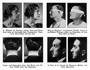 Plastic Surgery Before And After Prints: Plastic Surgery - Before and After