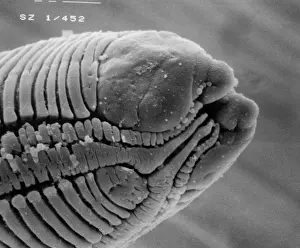 Scanning Electron Microscope Photos Prints: Roundworm