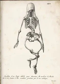 Rickets Skeleton Print